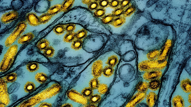 FILE -This colorized electron microscope image released by the National Institute of Allergy...